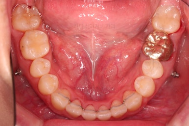 부산치아교정잘하는곳
