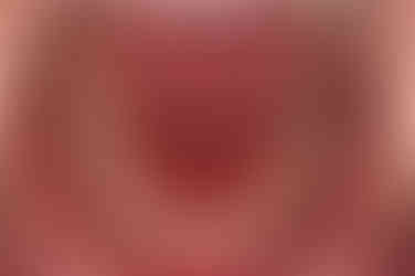 부산임플란트교정