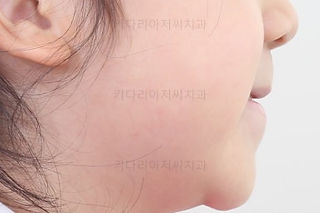 부산프리올소