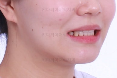 부산교정전문의