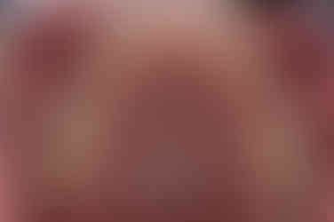 부산치아교정전문의