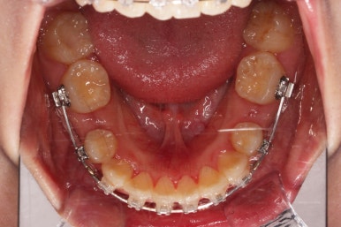부산무턱교정치과