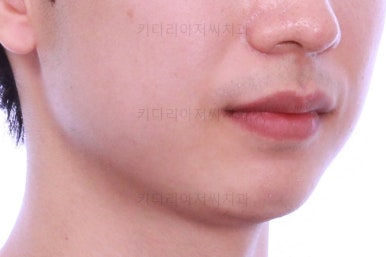 부산연제구교정