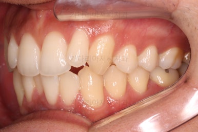 부산연제구교정