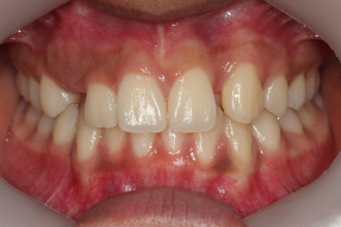 부산연산동청소년교정