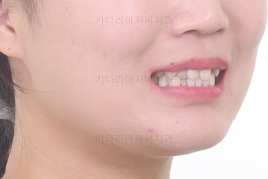 부산치아교정치과