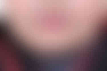 부산사각턱보톡스