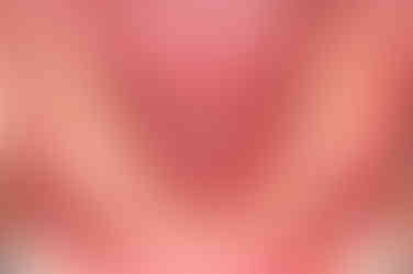 부산클리피씨교정