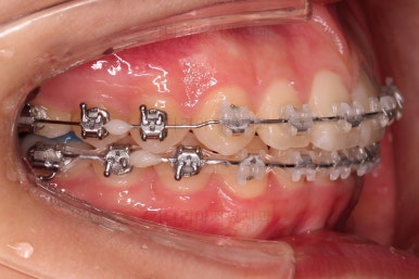 부산교정전문의