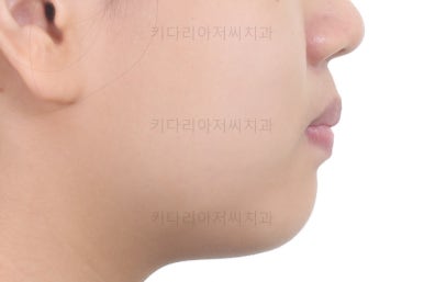 부산교정전문의
