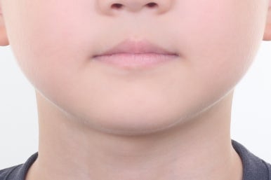 부산어린이치아교정