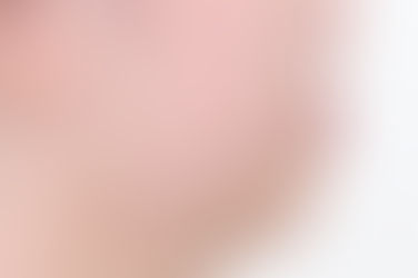 부산덧니교정