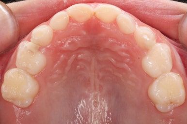 부산어린이치아교정