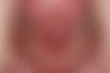 연산동교정치과