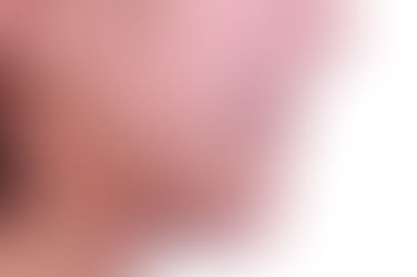 부산치아교정잘하는곳