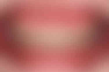 부산치아교정잘하는곳