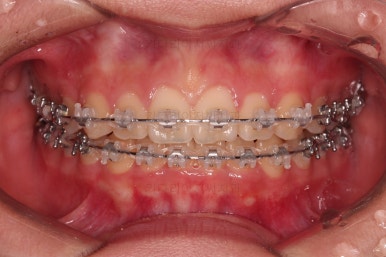 부산교정전문의