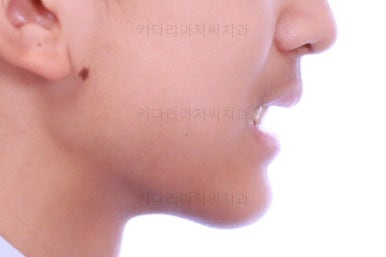 부산교정치과추천
