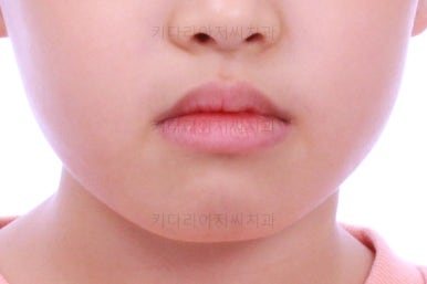 부산어린이교정