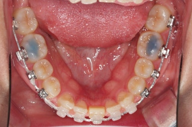 부산교정치과추천