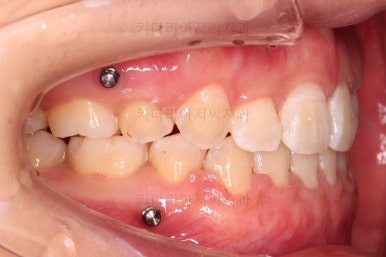 사직동교정치과