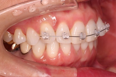 연산동부분교정