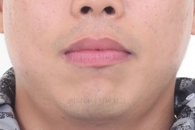 부산교정치과