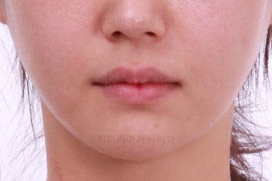 연산동교정치과