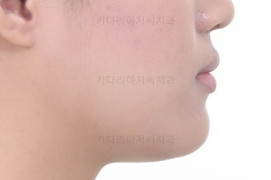 연산동치아교정치과