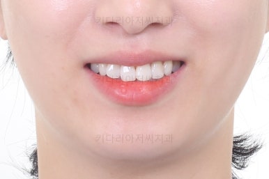 부산연산동부분교정