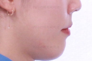부산교정
