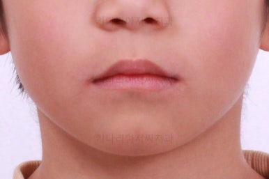 부산어린이교정