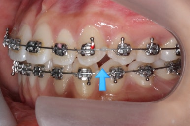 부산연산동청소년교정