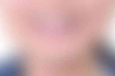 연산동치아교정