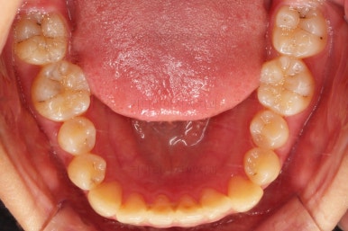 연산동교정치과