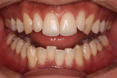 부산연제구교정