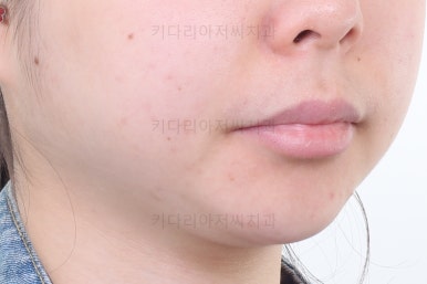 부산연산동교정치과