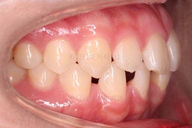 부산교정치과추천