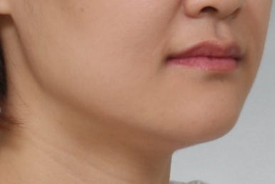 부산치아교정치과