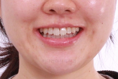 부산인비절라인