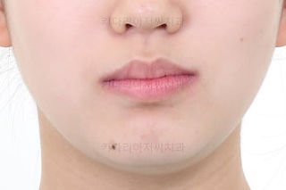 동래교정치과