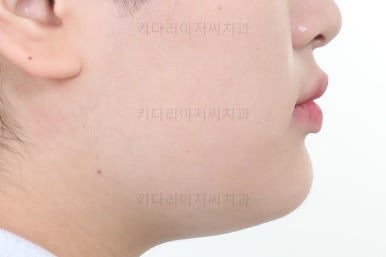 부산교정치과추천