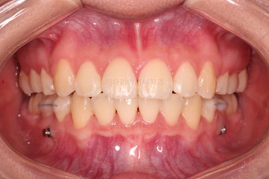 연산동치아교정치과