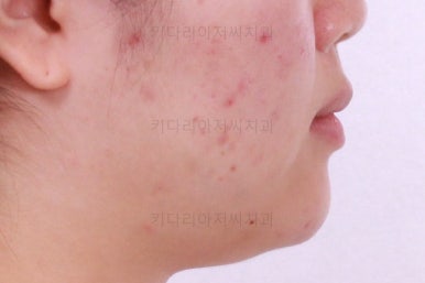부산치아교정치과