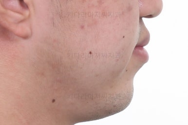 연산동교정전문치과