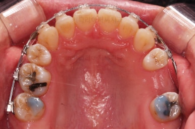 부산재교정치과