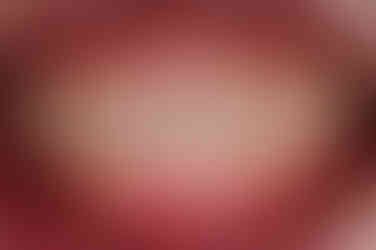 연산동임플란트