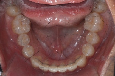 부산연산동청소년교정