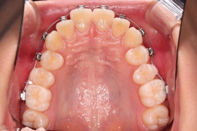 부산치아교정치과