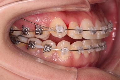 연산동교정치과